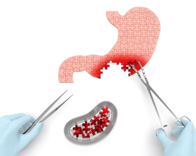 rak-zheludka-simptomy.jpg rak-zheludka-simptomy.jpg